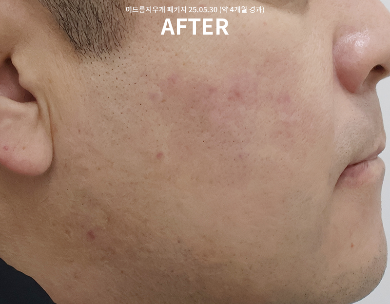 ab1d27bb0c92f1d1a816079283e806d1_1765178446_9619.png ab1d27bb0c92f1d1a816079283e806d1_1765178446_9619.png