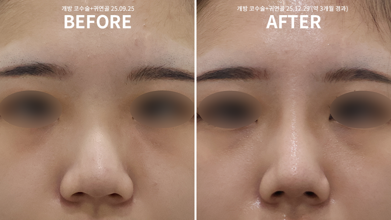 bc647c1b57629ee4c0bec5211461d7e9_1767084236_1928.png bc647c1b57629ee4c0bec5211461d7e9_1767084236_1928.png