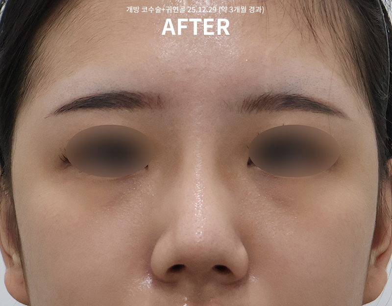 bc647c1b57629ee4c0bec5211461d7e9_1767084247_945.png bc647c1b57629ee4c0bec5211461d7e9_1767084247_945.png