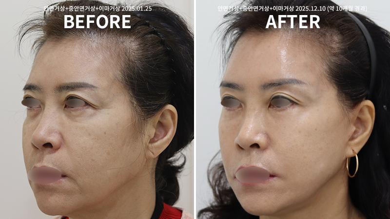 c45277a69e1e3cc06d797d6460a7bc6c_1765514517_9877.png c45277a69e1e3cc06d797d6460a7bc6c_1765514517_9877.png