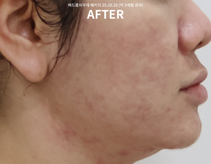 d03d8911594dbe73d8a5e94b50593f6f_1765273291_849.png d03d8911594dbe73d8a5e94b50593f6f_1765273291_849.png