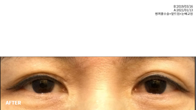 7c16365a1d00537cfc24e47fa298061f_1767279721_914.jpg 7c16365a1d00537cfc24e47fa298061f_1767279721_914.jpg