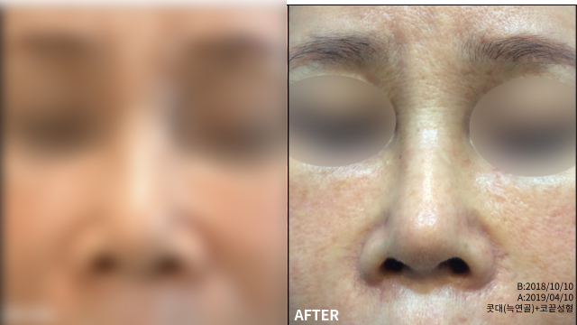 fbc482cefe2d2e26a00bd336ce85c769_1769774844_3936.jpg fbc482cefe2d2e26a00bd336ce85c769_1769774844_3936.jpg