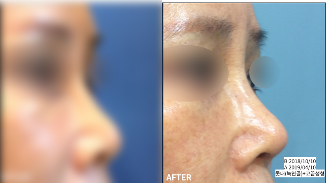 fbc482cefe2d2e26a00bd336ce85c769_1769774860_7416.jpg fbc482cefe2d2e26a00bd336ce85c769_1769774860_7416.jpg