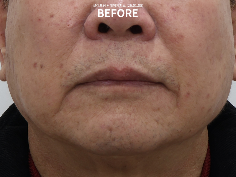 582b2061dab97d320601c3a785ed8350_1770613241_83.jpg 582b2061dab97d320601c3a785ed8350_1770613241_83.jpg