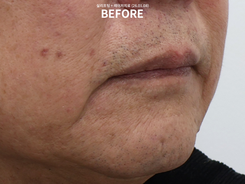 582b2061dab97d320601c3a785ed8350_1770613242_1978.jpg 582b2061dab97d320601c3a785ed8350_1770613242_1978.jpg