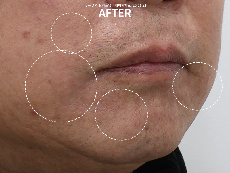 582b2061dab97d320601c3a785ed8350_1770613242_2741.jpg 582b2061dab97d320601c3a785ed8350_1770613242_2741.jpg