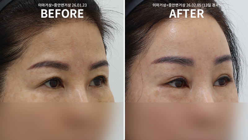 6aaa935d1f48552b904fbd15812d73fa_1771925629_3803.png 6aaa935d1f48552b904fbd15812d73fa_1771925629_3803.png