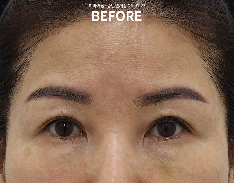 6aaa935d1f48552b904fbd15812d73fa_1771925637_6778.png 6aaa935d1f48552b904fbd15812d73fa_1771925637_6778.png