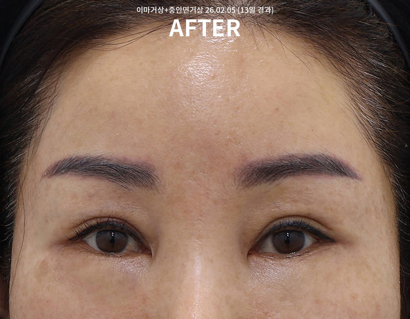 6aaa935d1f48552b904fbd15812d73fa_1771925637_7314.png 6aaa935d1f48552b904fbd15812d73fa_1771925637_7314.png