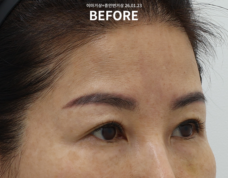 6aaa935d1f48552b904fbd15812d73fa_1771925637_7892.png 6aaa935d1f48552b904fbd15812d73fa_1771925637_7892.png