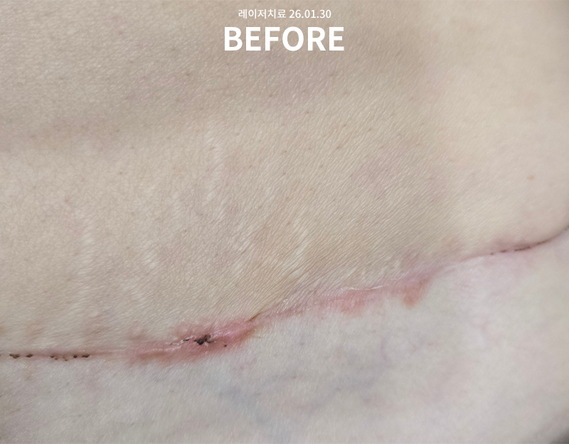 81e8a260bf0e3985de736a460515b345_1771557422_5414.png 81e8a260bf0e3985de736a460515b345_1771557422_5414.png