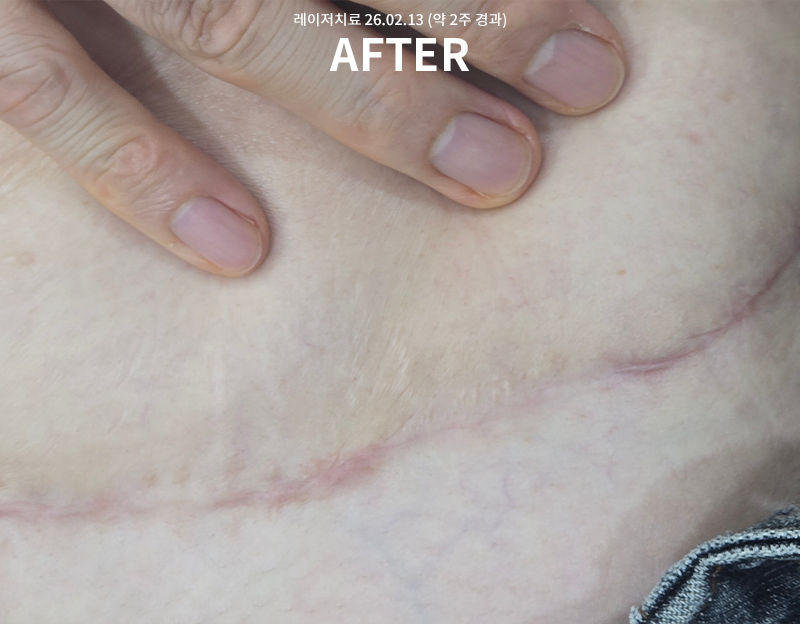 81e8a260bf0e3985de736a460515b345_1771557422_6036.png 81e8a260bf0e3985de736a460515b345_1771557422_6036.png