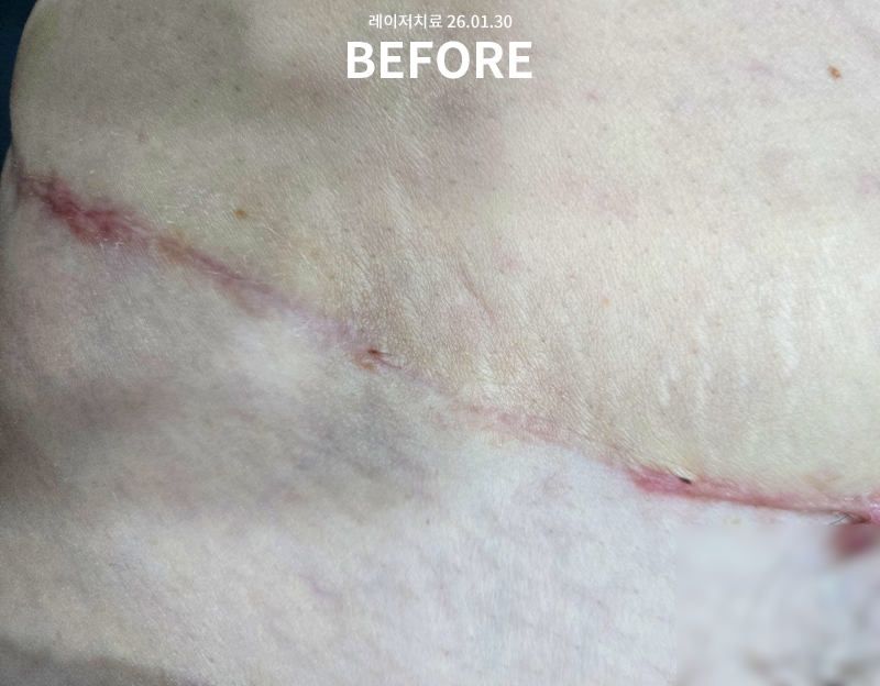 81e8a260bf0e3985de736a460515b345_1771557429_1659.png 81e8a260bf0e3985de736a460515b345_1771557429_1659.png