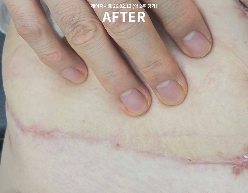 81e8a260bf0e3985de736a460515b345_1771557429_2371.png 81e8a260bf0e3985de736a460515b345_1771557429_2371.png