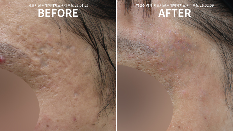 83be100bedc9922514d7c6aa0fb83482_1770621864_4637.jpg 83be100bedc9922514d7c6aa0fb83482_1770621864_4637.jpg