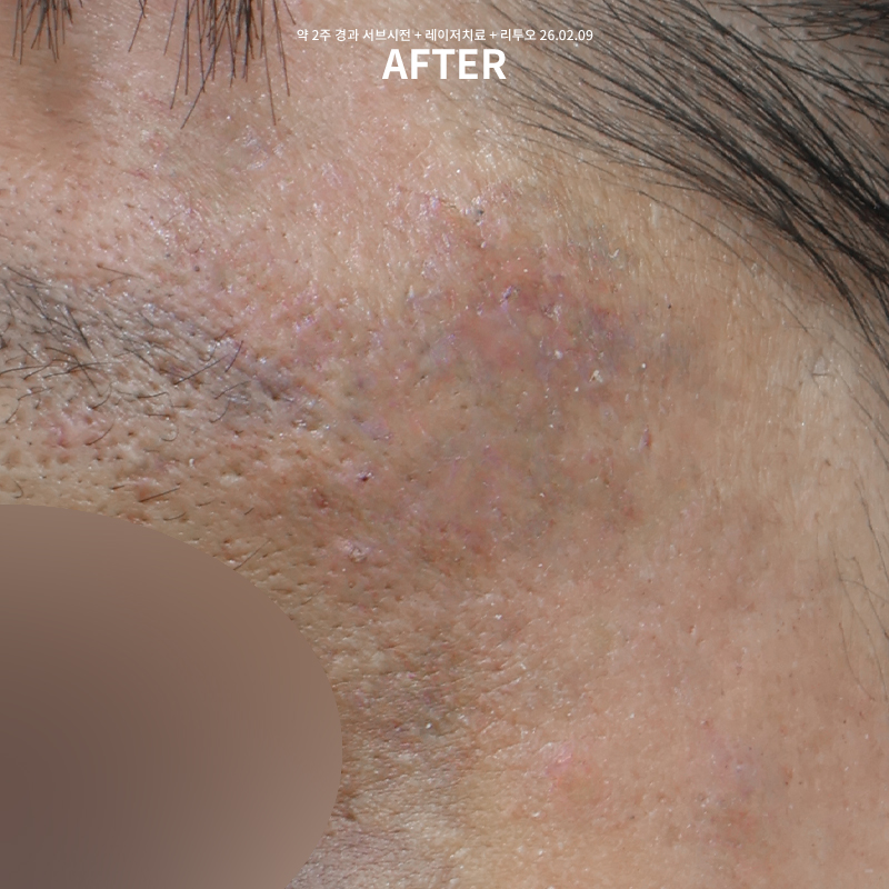 83be100bedc9922514d7c6aa0fb83482_1770621864_5841.jpg 83be100bedc9922514d7c6aa0fb83482_1770621864_5841.jpg