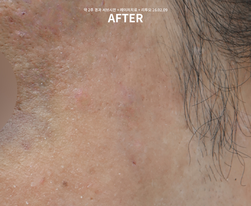 83be100bedc9922514d7c6aa0fb83482_1770621864_7075.jpg 83be100bedc9922514d7c6aa0fb83482_1770621864_7075.jpg