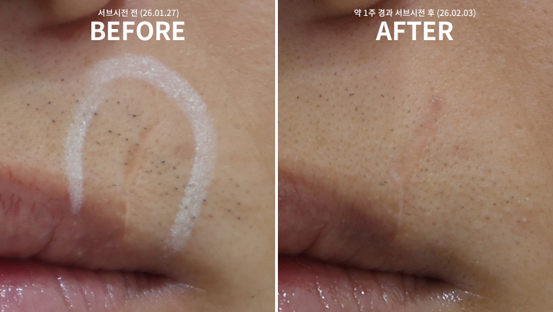 bf8561541f253a263c30354851ff205a_1770342249_3051.jpg bf8561541f253a263c30354851ff205a_1770342249_3051.jpg