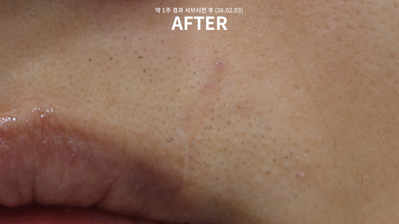 bf8561541f253a263c30354851ff205a_1770342249_4225.jpg bf8561541f253a263c30354851ff205a_1770342249_4225.jpg