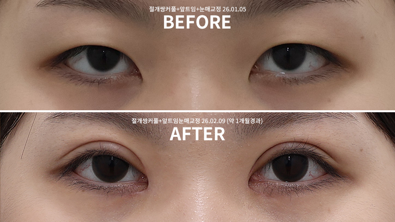 cc6725c48c356e37084a0feabafd02bb_1770709103_2658.png cc6725c48c356e37084a0feabafd02bb_1770709103_2658.png