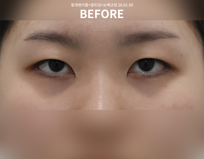 cc6725c48c356e37084a0feabafd02bb_1770709105_8481.png cc6725c48c356e37084a0feabafd02bb_1770709105_8481.png