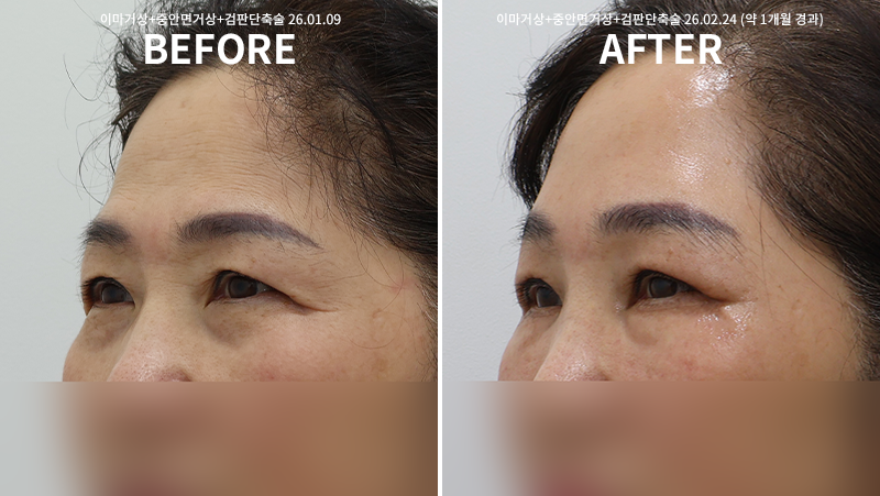 e70e4c048d1f897fe830a83d048d0b01_1772008972_965.png e70e4c048d1f897fe830a83d048d0b01_1772008972_965.png