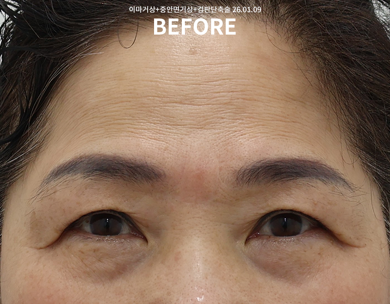 e70e4c048d1f897fe830a83d048d0b01_1772008981_9574.png e70e4c048d1f897fe830a83d048d0b01_1772008981_9574.png