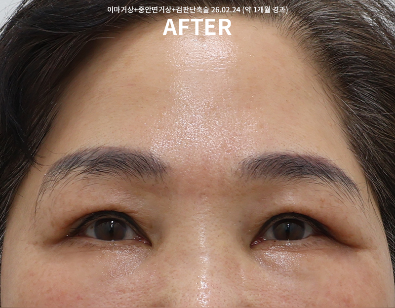 e70e4c048d1f897fe830a83d048d0b01_1772008982_0558.png e70e4c048d1f897fe830a83d048d0b01_1772008982_0558.png