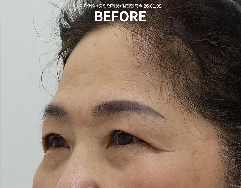 e70e4c048d1f897fe830a83d048d0b01_1772008982_1555.png e70e4c048d1f897fe830a83d048d0b01_1772008982_1555.png