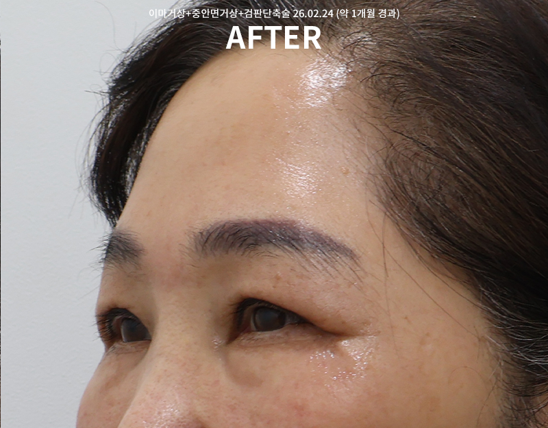 e70e4c048d1f897fe830a83d048d0b01_1772008982_2195.png e70e4c048d1f897fe830a83d048d0b01_1772008982_2195.png