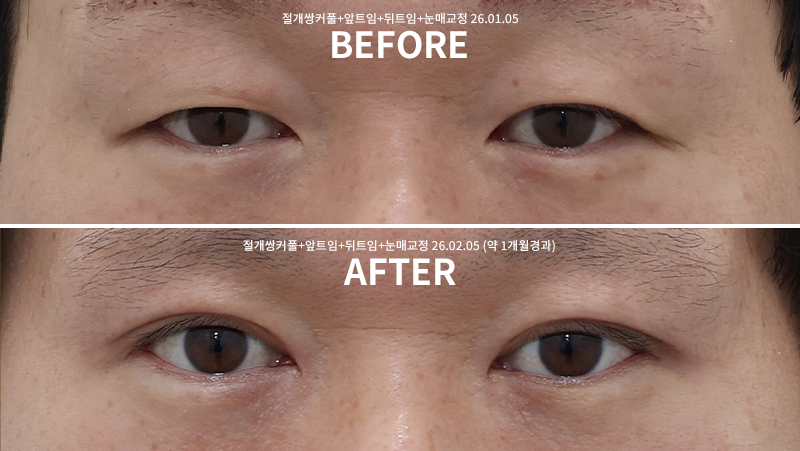 eef450db957903f0df1f0dc71f558ff4_1770613873_328.png eef450db957903f0df1f0dc71f558ff4_1770613873_328.png