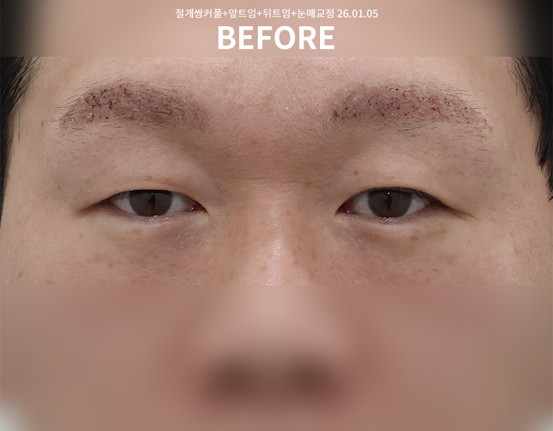 eef450db957903f0df1f0dc71f558ff4_1770613873_3886.png eef450db957903f0df1f0dc71f558ff4_1770613873_3886.png