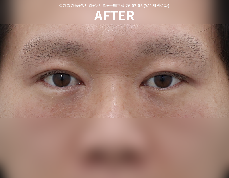 eef450db957903f0df1f0dc71f558ff4_1770613873_4492.png eef450db957903f0df1f0dc71f558ff4_1770613873_4492.png