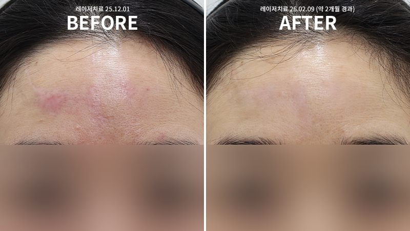 eef450db957903f0df1f0dc71f558ff4_1770620821_7701.png eef450db957903f0df1f0dc71f558ff4_1770620821_7701.png