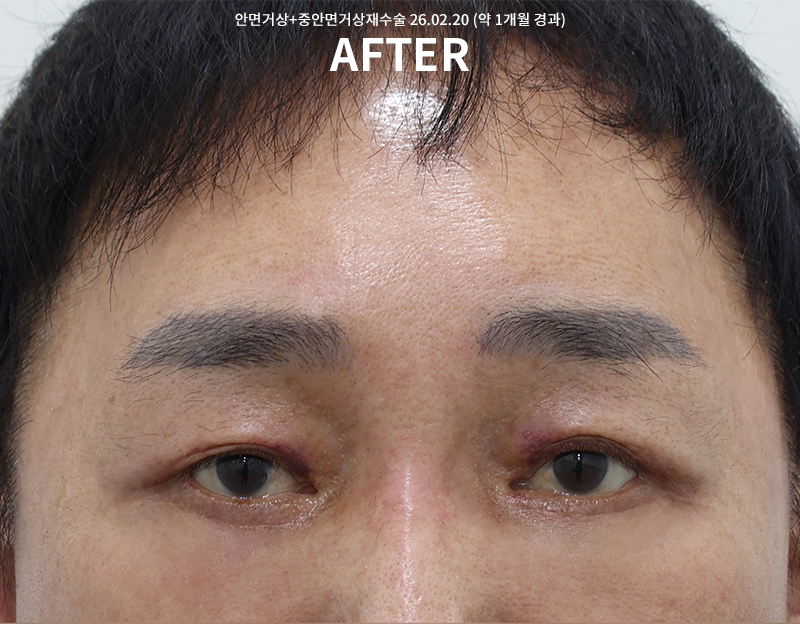 f8389aea29823bbece55de63641a445e_1771983576_0228.png f8389aea29823bbece55de63641a445e_1771983576_0228.png