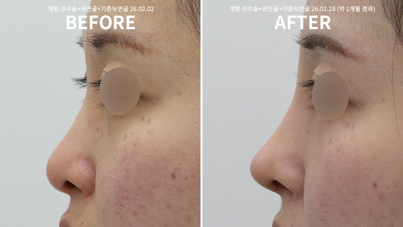 3d56e98a7e269804fe5945593c3c3356_1772522521_4552.png 3d56e98a7e269804fe5945593c3c3356_1772522521_4552.png