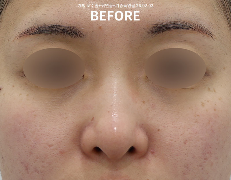 3d56e98a7e269804fe5945593c3c3356_1772522557_3803.png 3d56e98a7e269804fe5945593c3c3356_1772522557_3803.png