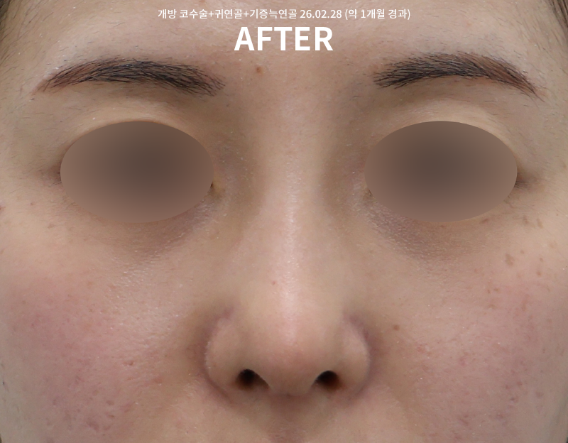 3d56e98a7e269804fe5945593c3c3356_1772522557_4312.png 3d56e98a7e269804fe5945593c3c3356_1772522557_4312.png