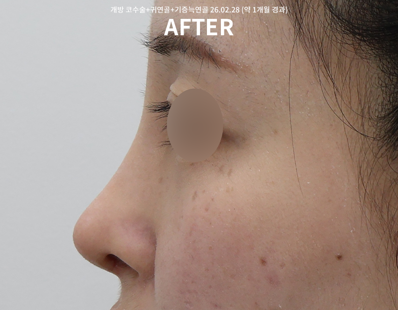 3d56e98a7e269804fe5945593c3c3356_1772522557_5388.png 3d56e98a7e269804fe5945593c3c3356_1772522557_5388.png