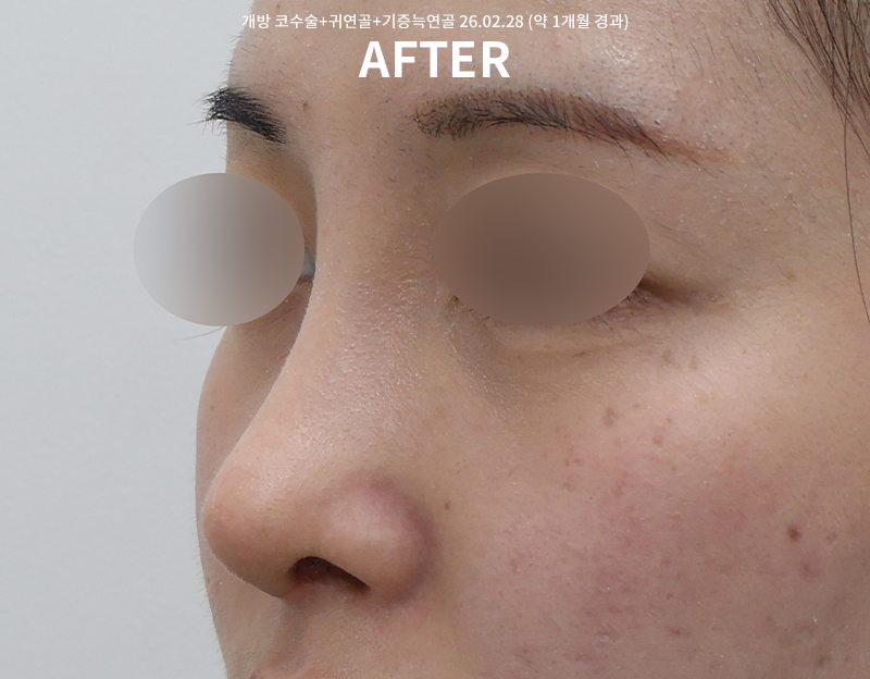 3d56e98a7e269804fe5945593c3c3356_1772522557_6453.png 3d56e98a7e269804fe5945593c3c3356_1772522557_6453.png