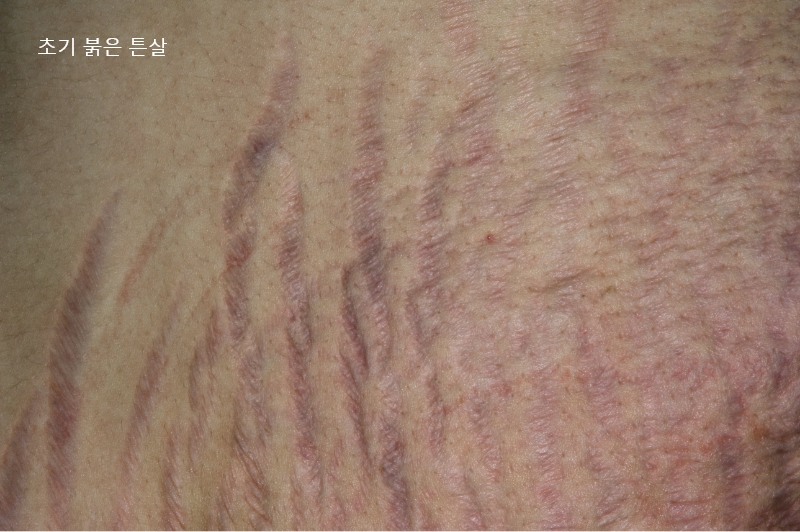 bc3b2bb2489e7ebde460f35d3f225d5a_1776044539_6124.jpg bc3b2bb2489e7ebde460f35d3f225d5a_1776044539_6124.jpg