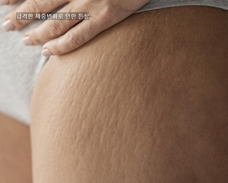 bc3b2bb2489e7ebde460f35d3f225d5a_1776044541_7137.jpg bc3b2bb2489e7ebde460f35d3f225d5a_1776044541_7137.jpg