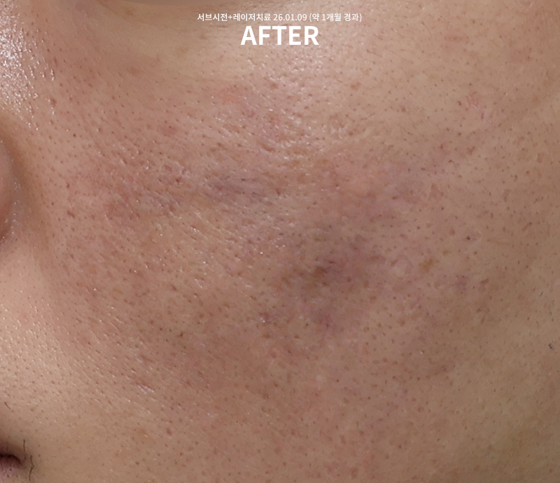 d0aee182af264e2566d2529087560505_1775531471_0009.png d0aee182af264e2566d2529087560505_1775531471_0009.png