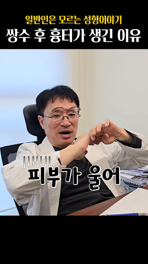 쌍수후흉터가생기는이유