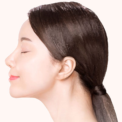 미니거상수술방법4봉합