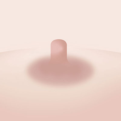 유두축소수술방법1