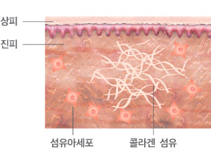울쎄라 회복 과정3